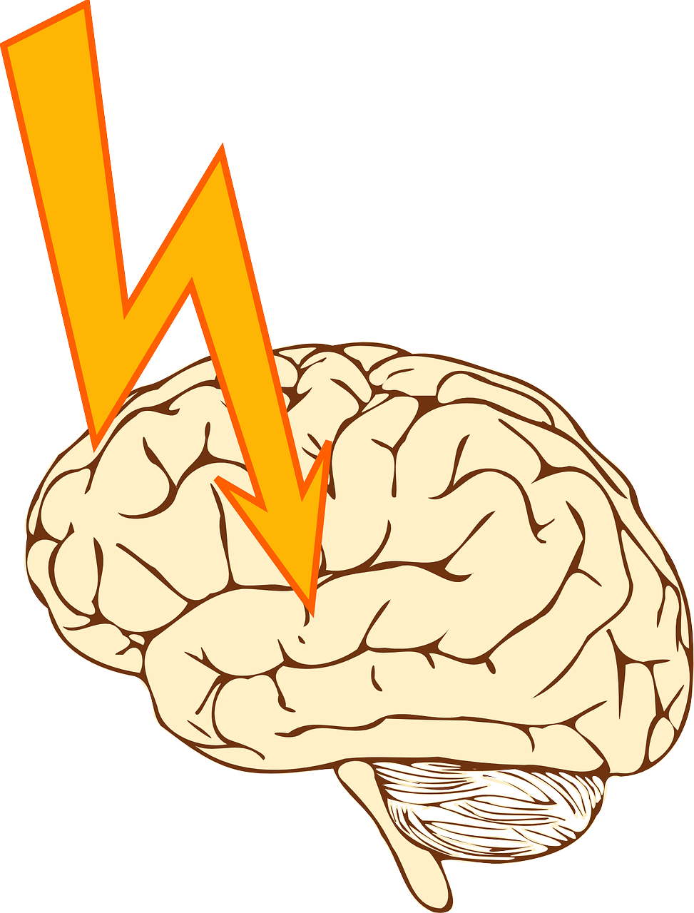 More Can Be Done for Patients Who Had Minor Strokes