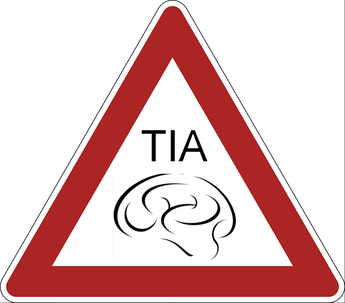FIRST COMES TIA, THAN COMES STROKE #StrokeEurope